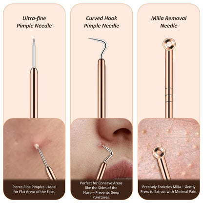 2025 Newest Blackhead Remover Pore Vacuum,USB Rechargeable Blackhead extractor